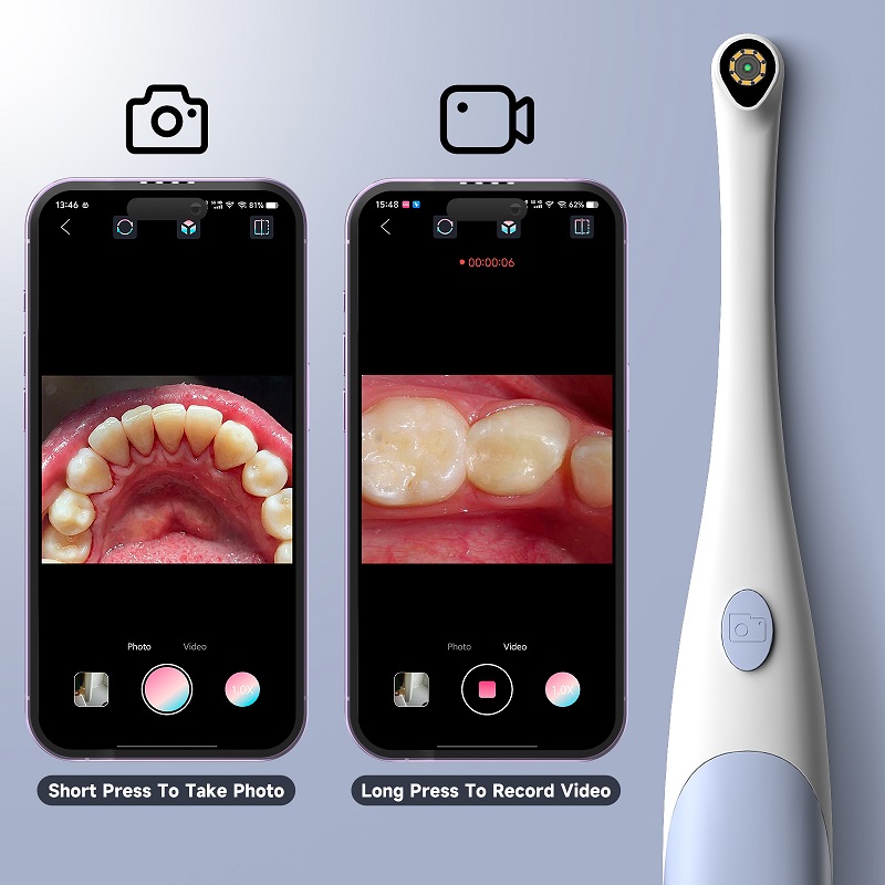 Oral Endoscope Camera 1440P Ph - đánh giá và giá Photography Lighting Spotlight
